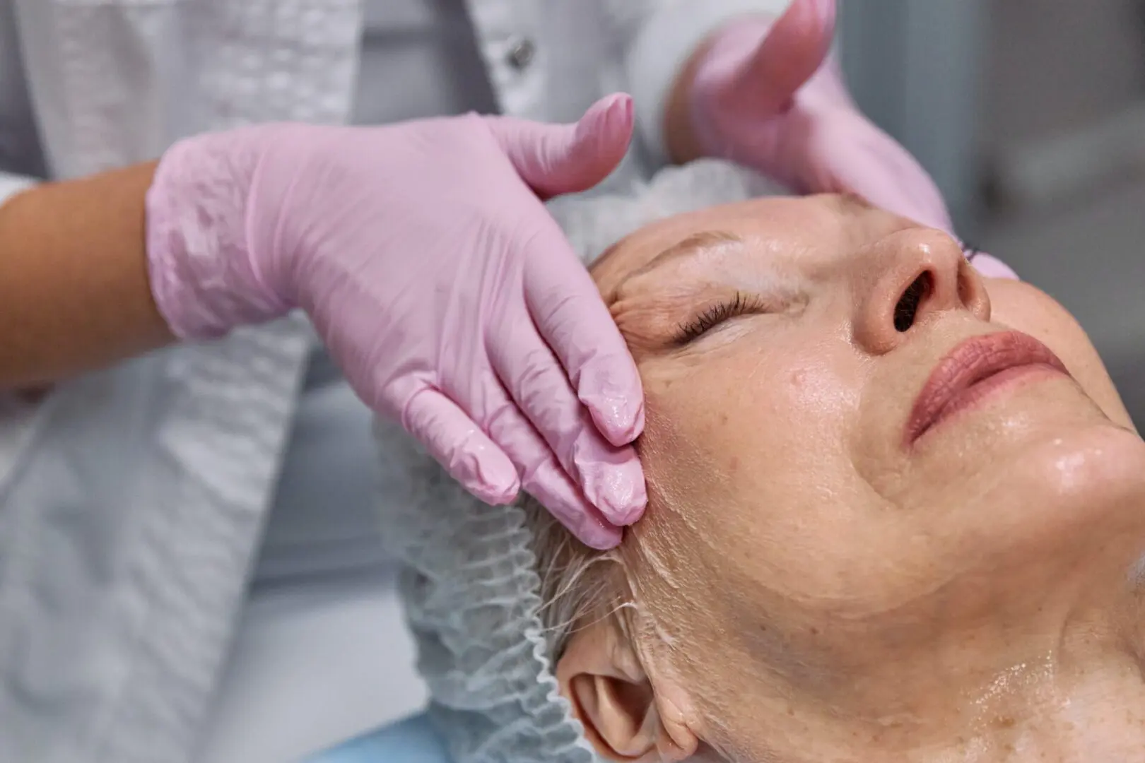 A woman getting her face waxed by a person wearing gloves.